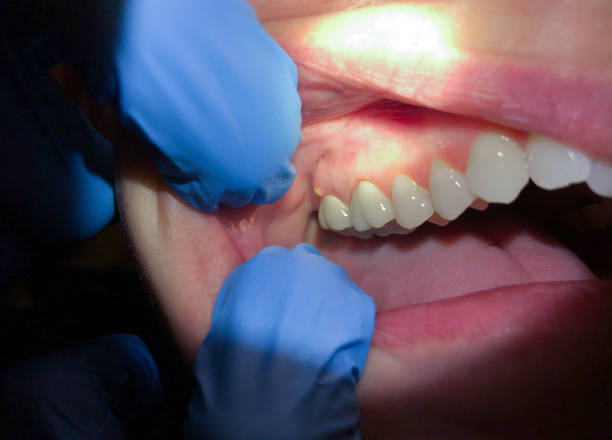 Best Same-Day Emergency Dentist in Maysville, NC
