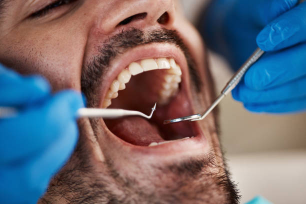 Best Emergency Root Canal Treatment in Maysville, NC